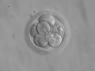 300px-Embryo,_8_cells.jpg
